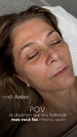 Estética mães 🔥