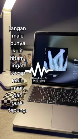 JANGAN MALU PUNYA
