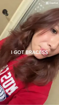 LOOK AT MY GRILLSS