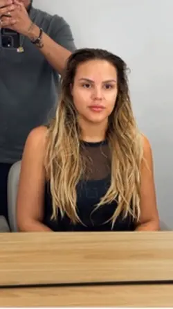 antes e depois