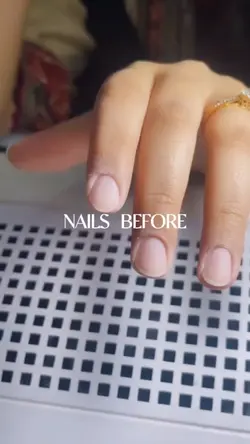 BEFORE & AFTER NAILS