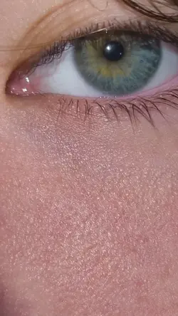 my Friends eyes