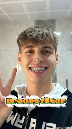 Braces filter
