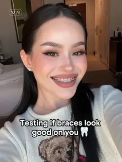 BRACES AI