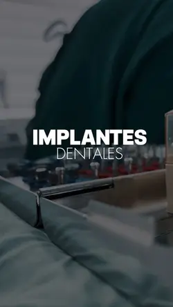 Implantes dentales 
