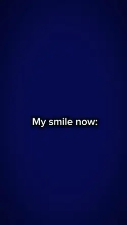 My smile