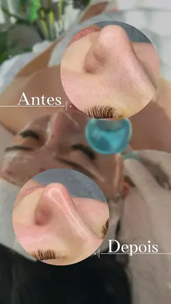 Limpeza de pele