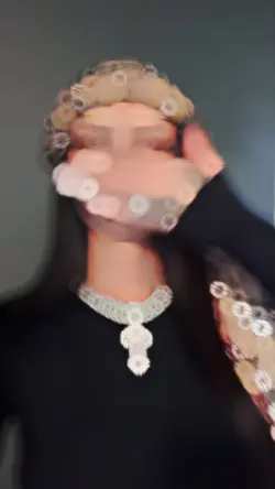 Viral