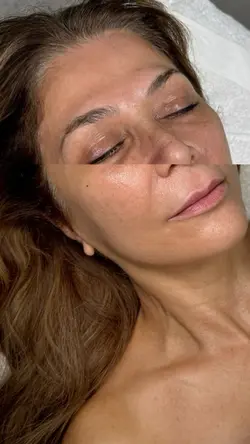 Transition / results