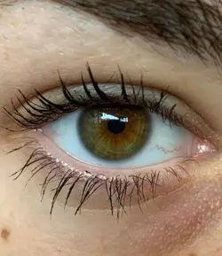 Filter