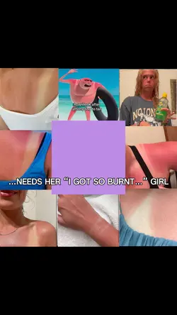 I’m the burnt one 😭