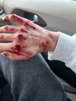 Wounds effect ai 