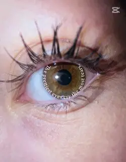 Eyes