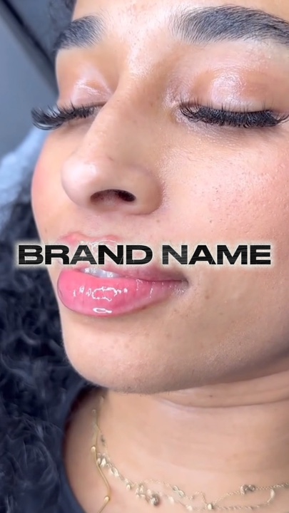 Lip filler