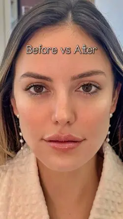 Before vs After 
