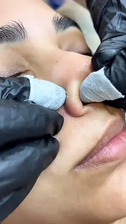 Skin cleansing