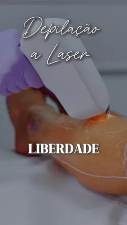 Depilação a laser 🏆