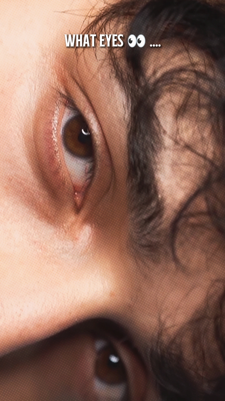 what Eyes ...