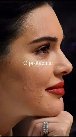 Limpeza de Pele 