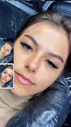 ANTES E DEPOIS LASH