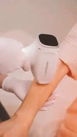 Laser hair removal ✨