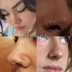 i have an itch