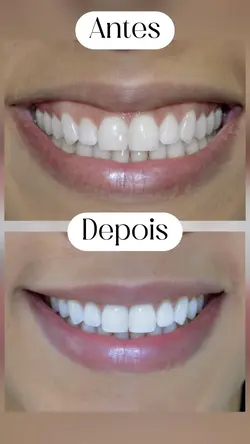 Antes e depois