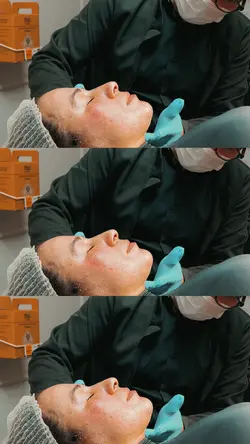 Estética facial