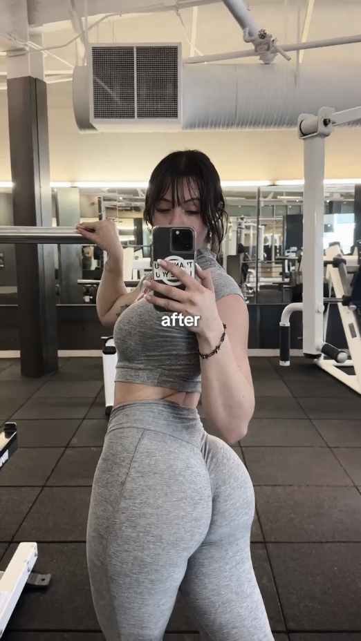 Antes Depois 