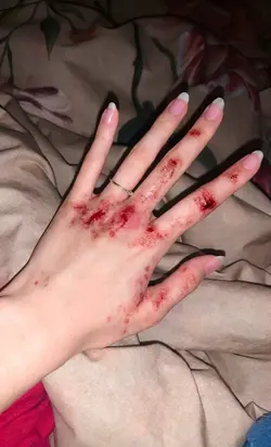 ai wounds prank