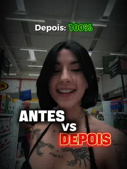 antes vs depois
