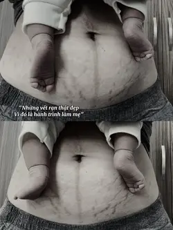 Làm mẹ