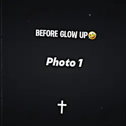Before glow up🤮