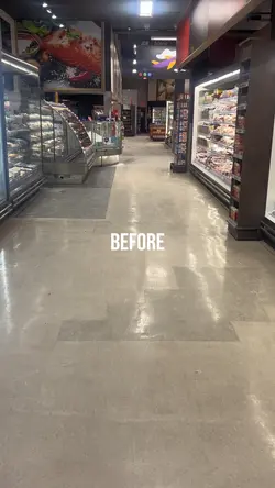 BEFORE&AFTER 3X ❗️