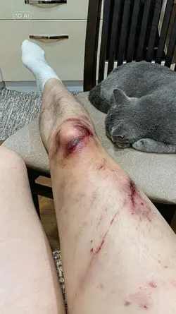 AI WOUNDS |