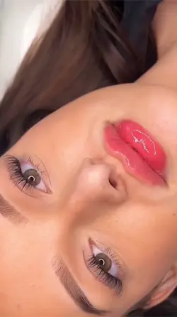 Microneedling aesthe