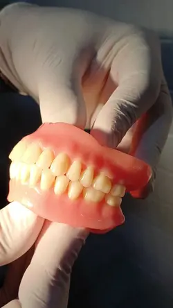 Prótese dentaria 