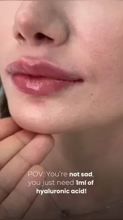 LIPFILLER aesthetic