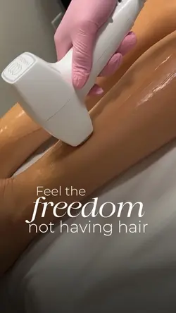 Hair removal laser