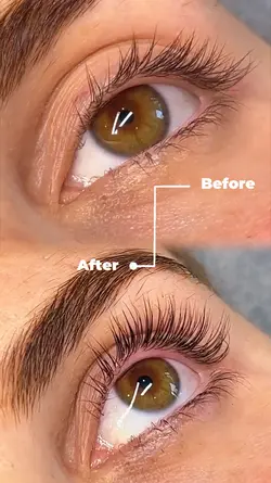 Before and after las