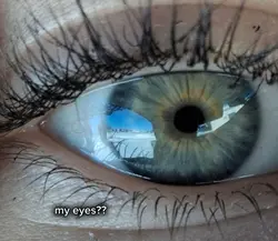 unique eyes
