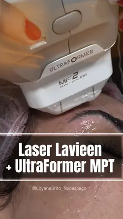Laser Lavieen 