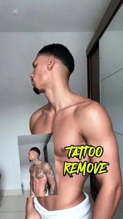 TATTO REMOVAL 
