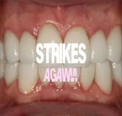 bigmouthstrikesagain