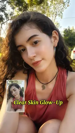 Clear Skin Glow-Up