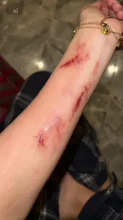 wounds effect ai 