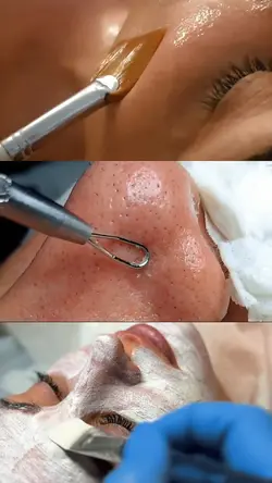 Skincare SPA