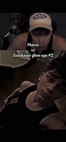 Glow ups