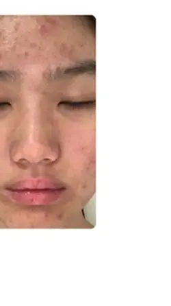 Real results!