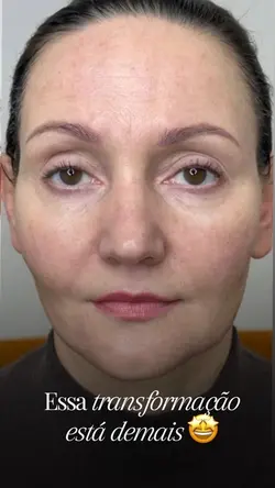 Antes e depois FACE